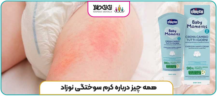 همه چیز درباره کرم سوختگی نوزاد